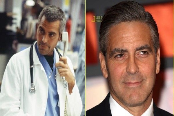 George Clooney, fotos de resultados del injerto capilar