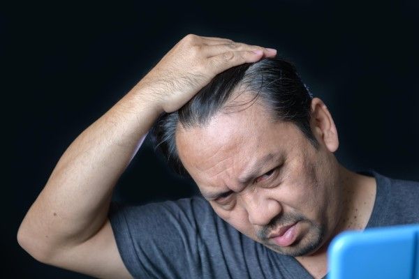Hombre asiático con problemas capilares