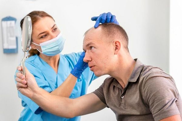 injerto capilar en turquía- Médico examinando el cuero cabelludo de paciente con alopecia