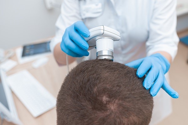 Técnica Fue con implanters - tricóloga en la consulta realizando una evaluación del cabello del paciente para un posible injerto capilar