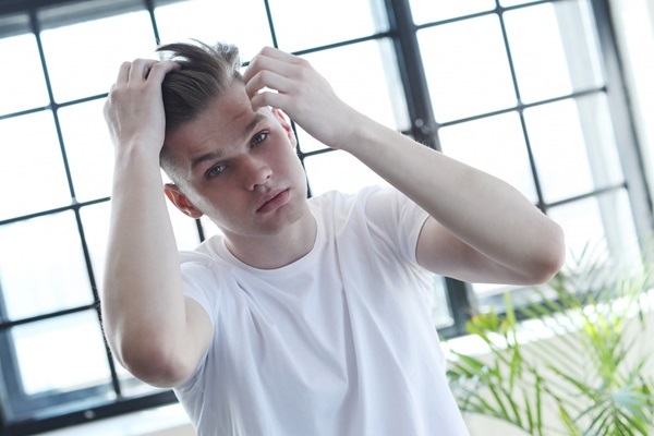 Alopecia prematura - Hombre adolescente con alopecia androgénica en las entradas tacándose el cabello con las manos