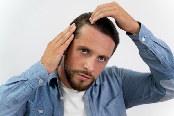 Dejar el alcohol en el injerto capilar - Hombre con caída del pelo en las entradas tocándose el cabello con la mano para peinarse