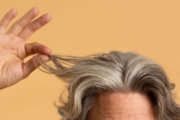 Injerto de pelo con canas - Hombre sujetando en su mano un mechón de cabello blanco con canas luego de un implante capilar