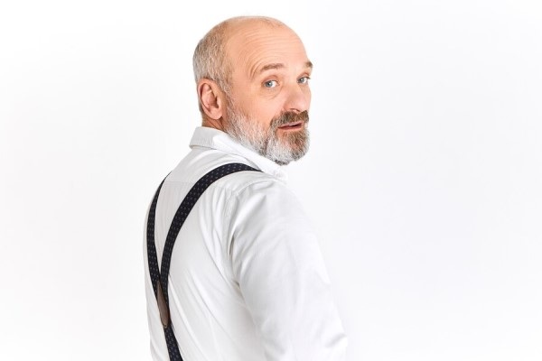 Hombre con alopecia androgénica que causa la pérdida de cabello en las entradas y coronilla