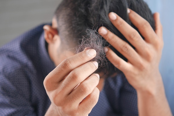 Olumiant - Hombre sosteniendo en sus manos cabello que se cae debido a la alopecia areata