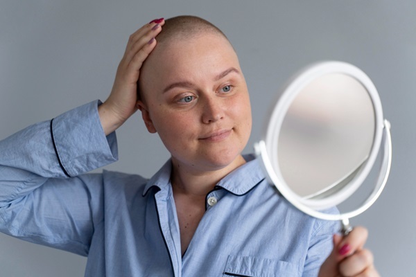 Cáncer y pérdida del pelo - Mujer con alopecia debido a las consecuencias del cáncer observándose en el espejo mientras pone su mano en la cabeza