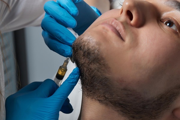 Injerto de barba - Médico capilar realizando un implante de barba a un hombre para aumentar la densidad del vello facial