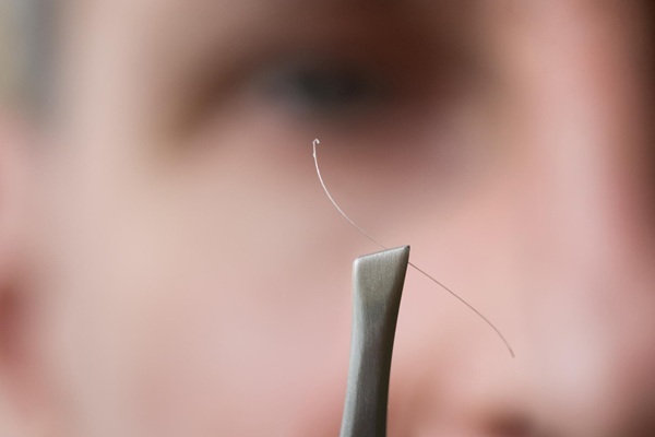 Pelo con raíz blanca - Persona sosteniendo en una pinza un cabello con raíz blanca que se cae como parte del ciclo de crecimiento capilar