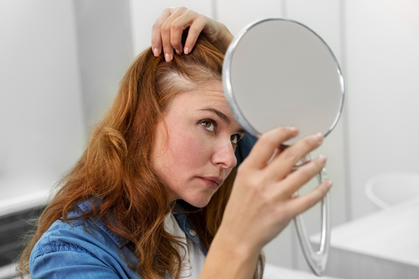 Alopecia frontal fibrosante - Mujer observando en un espejo la pérdida de cabello que presenta debido a la alopecia frontal femenina