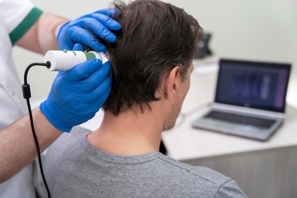 Injerto cabello costo - Médico capilar evaluando la densidad del cabello donante de un hombre para verificar si es un buen candidato para el injerto de cabello CDMX