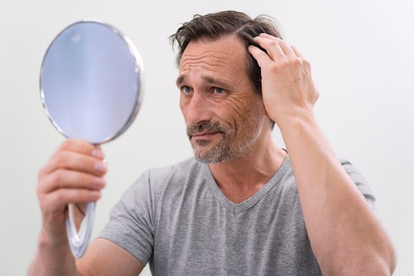 Problemas capilares más comunes - Hombre observando en el espejo el avance de la pérdida de cabello como consecuencia de una salud capilar inadecuada