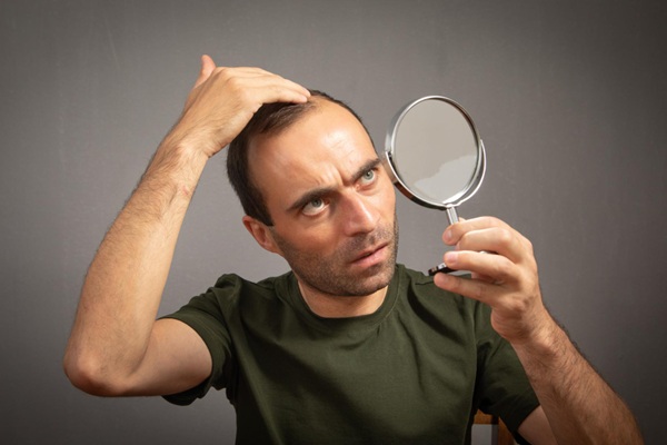 Tabaco y alopecia - Hombre observando en un espejo el avance de la pérdida capilar debido a los efectos negativos del tabaco y humo de los cigarros