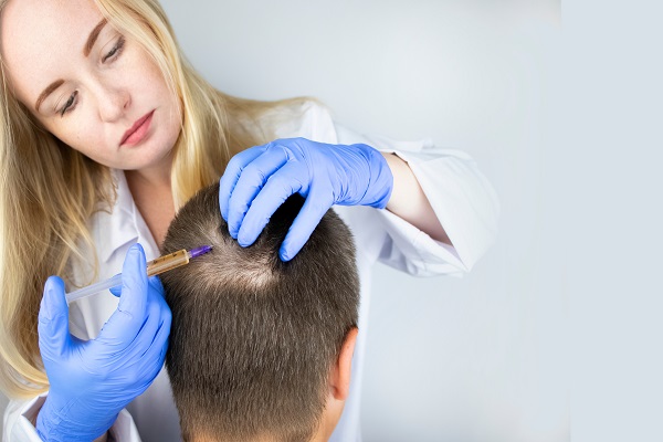 Cuáles son las clases de trasplantes que existen y como esto se relaciona con si se puede injertar cabello de otra persona