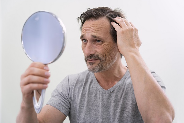 Puede haber rechazo en un implante capilar y como esto responde a si se puede injertar cabello de otra persona