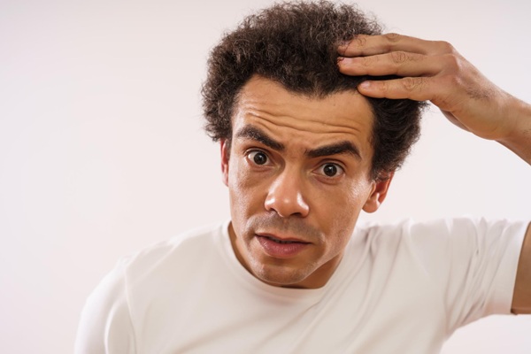 Trasplante cabello rizado - Hombre preocupado por la alopecia en las entradas que presenta la cual se soluciona con un microimplante de cabello rizado