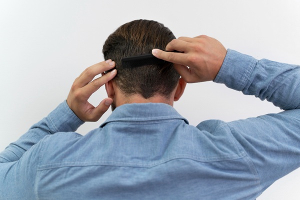 Técnica FUSS en injerto de cabello - Hombre peinando su pelo abundante y saludable luego de un injerto de cabello CDMX