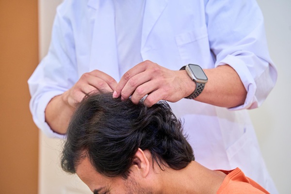 Médico capilar evaluando el cuero cabelludo de un hombre con alopecia en la mejor clínica injerto cabello CDMX