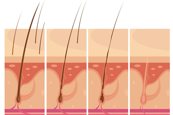 Por qué no me crece el cabello - Imagen representativa del ciclo de vida del pelo para entender por qué da la alopecia