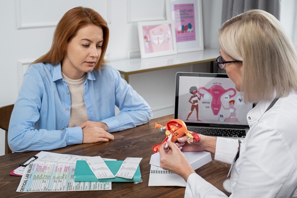Calvicie en mujeres - Médico usando una maqueta del aparato reproductor femenino para explicarle a una mujer que el síndrome de ovario poliquístico causa los síntomas de alopecia
